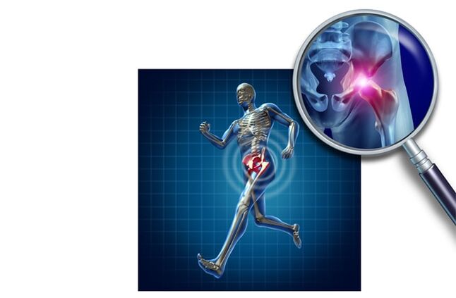 Durere atunci când alergi în articulația șoldului